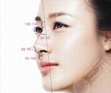 八大處范飛隆鼻整形圖片：術(shù)后3個月恢復(fù)狀態(tài)參考！