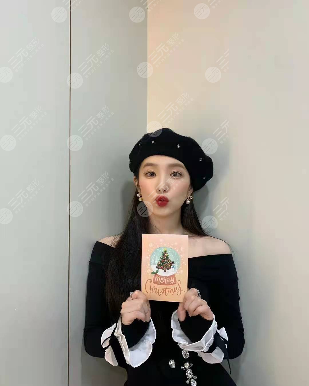 Irene裴珠泫狀態(tài)良好，顏值回春?