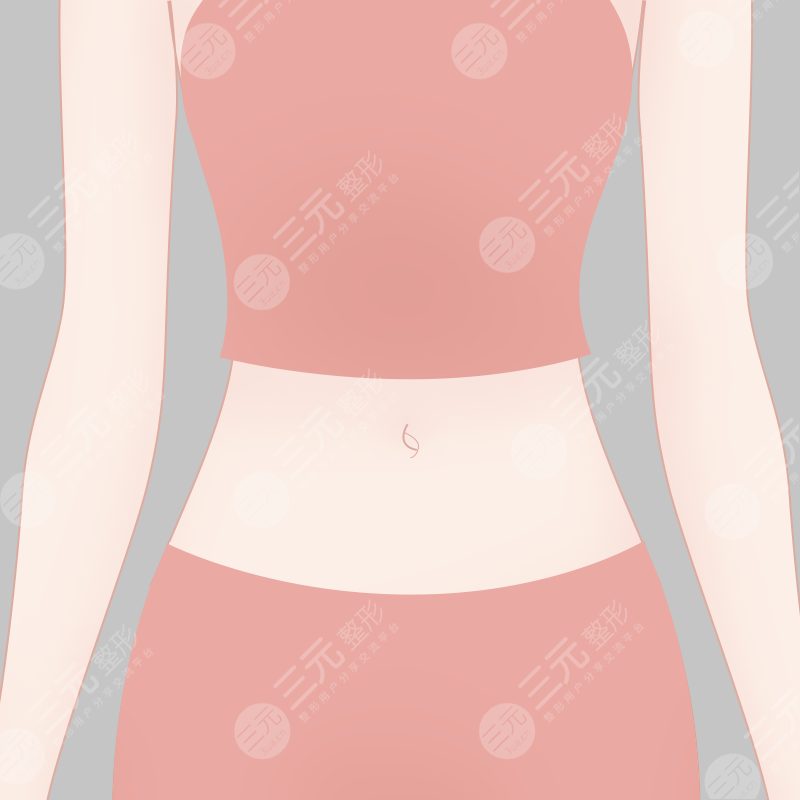 寧波市第六醫(yī)院整形科吸脂案例術前