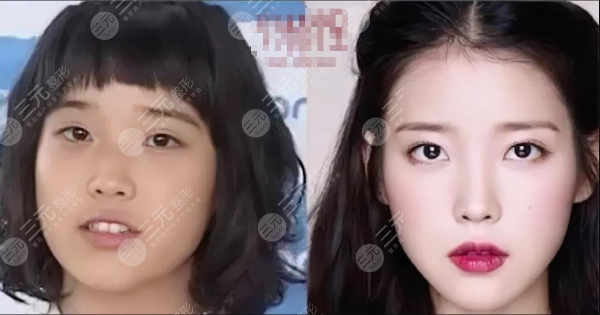 顏值分析|IU李知恩變美思路？不動(dòng)骨微調(diào)也能變女神！整容史盤點(diǎn)！