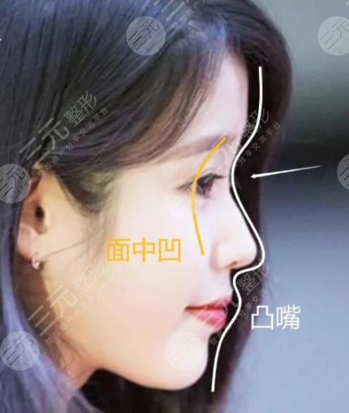 IU臉上動(dòng)過哪些地方?