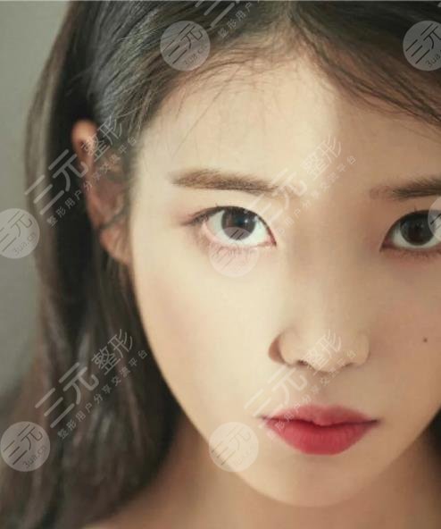 IU顏值高嗎?整容過嗎?