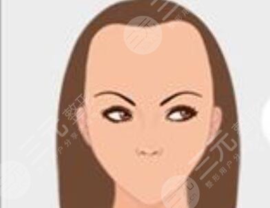 鄭州植發(fā)醫(yī)院排行榜