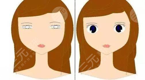 謝衛(wèi)國隆鼻術(shù)前