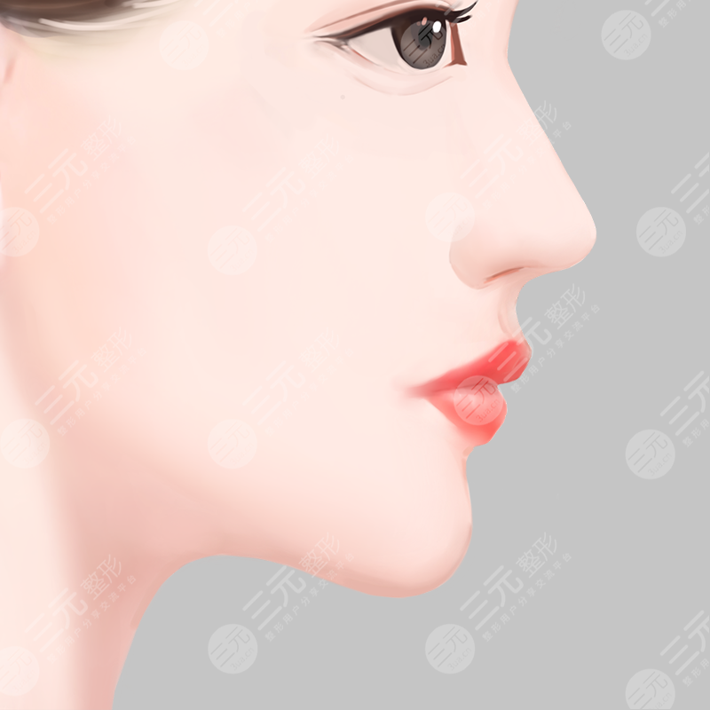 謝衛(wèi)國做鼻子風(fēng)格，術(shù)后：無懼揉捏/不卷曲/恢復(fù)快