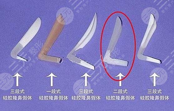 謝衛(wèi)國隆鼻術(shù)后3個(gè)月