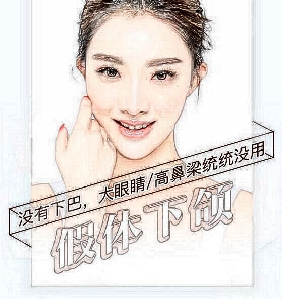 西京整形醫(yī)院假體墊下巴真實(shí)案例分享