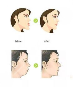 上海瑞泰口腔醫(yī)院種植牙案例分享