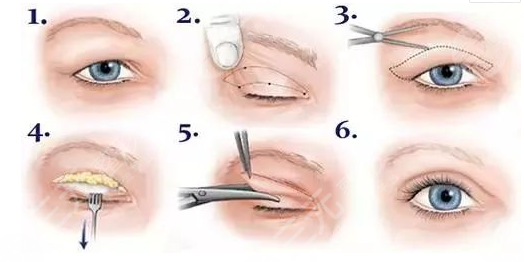 蘭大二院整形科價(jià)格表2021新版，醫(yī)生簡介|雙眼皮修復(fù)案例