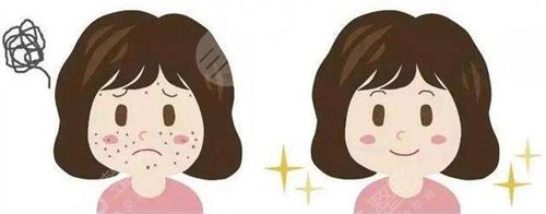 湖南中醫(yī)附一祛斑案例前