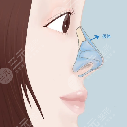 廣州韓佳人整形醫(yī)院怎么樣？價格表2021搶先一覽