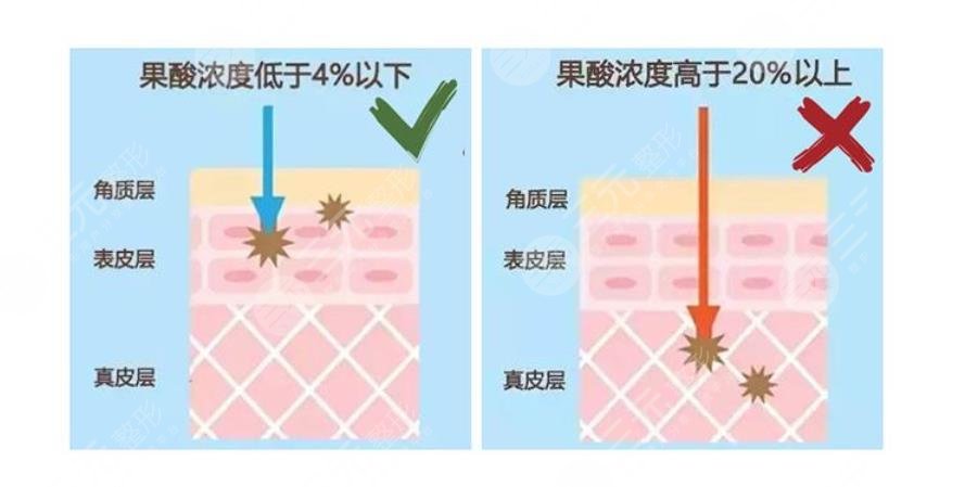 4問4答|讓你更懂！新手必備干貨~