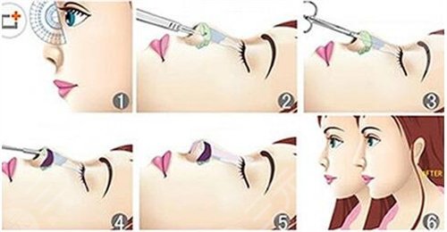 手術(shù)后147天