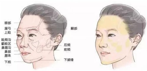 真人體驗(yàn)熱拉提果反饋術(shù)前