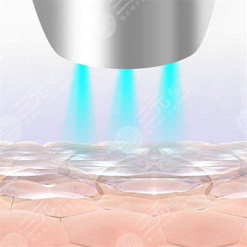 臉上紅血絲如何去除？怎么修復？注意事項