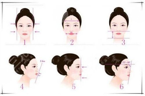 溶脂瘦下巴案例