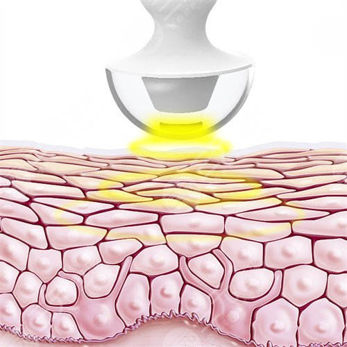 熱瑪吉術(shù)中