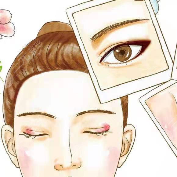 易陽艷割雙眼皮手術(shù)反饋