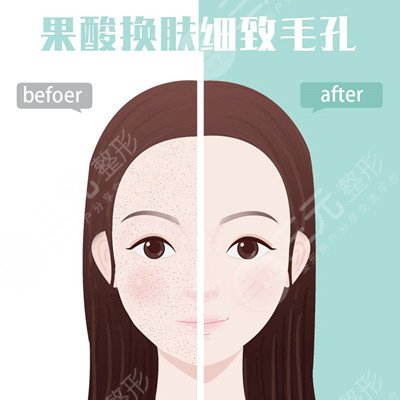 果酸換膚手術(shù)之后的半年