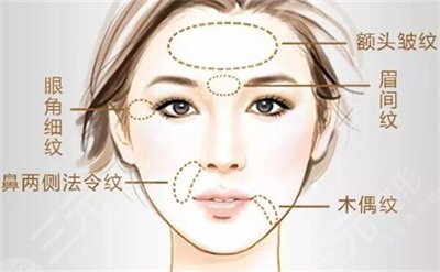 雷達(dá)提升抗皺做一次多少錢?有3個(gè)影響價(jià)格的因素!小白術(shù)前必看~