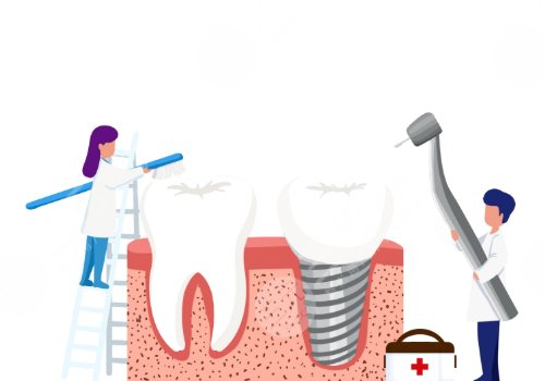 2022全國種植牙價格表種植牙的價格表