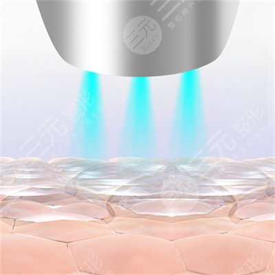 秀眉的價(jià)格一般多少錢?危害有哪些?