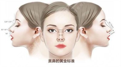 自體軟骨隆鼻可以長時間嗎?