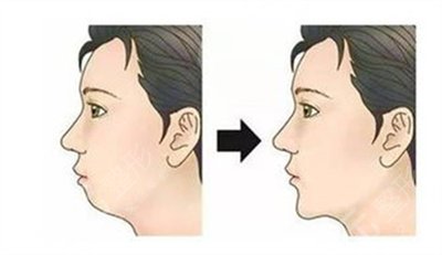 葫蘆島亞東口腔正畸怎么樣