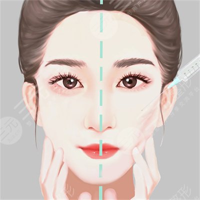 ****注射瘦臉多少錢一針?