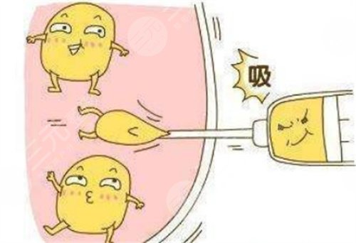 江蘇省中醫(yī)院整形外科注射瘦腿果圖