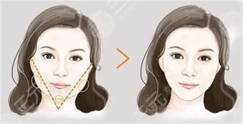 杭州中醫(yī)院美容科醫(yī)生信息公開(kāi)，全新價(jià)格表上線，附真人案例圖~