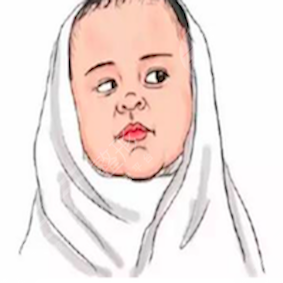 貴陽美貝爾整形口碑如何？誠意分享B****術(shù)后對比