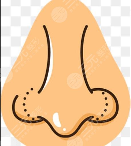 上海伊萊美王世專隆鼻案例恢復(fù)果分享