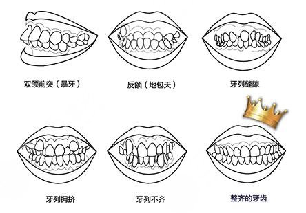 烏魯木齊牙齒矯正案例