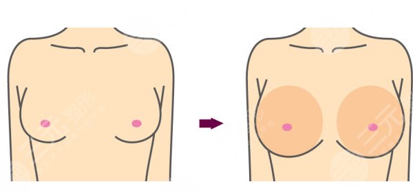 魔滴和曼托怎么選擇？魔滴和曼托的區(qū)別有哪些？