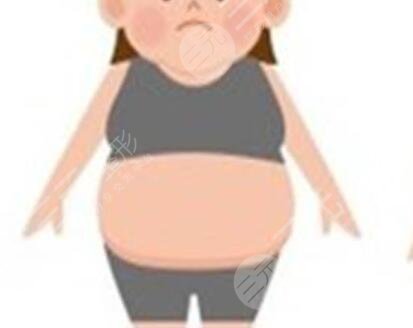 北京東方和諧醫(yī)療大腿吸脂案例