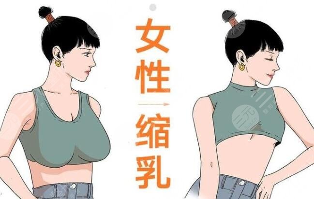 棒棒糖縮胸手術(shù)多少天完全消腫？