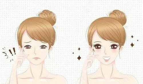 重慶眼部整形案例