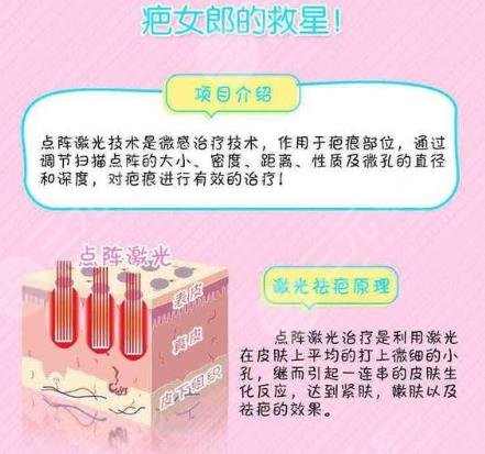 深圳激光去疤痕有嗎?