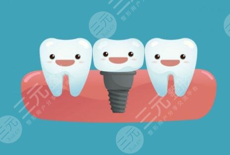 廈門市口腔醫(yī)院種植牙手術(shù)經(jīng)歷分享