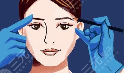 雙眼皮手術(shù)后