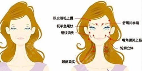 面部拉皮手術(shù)提升果和視頻賞析，多久能夠恢復(fù)？趕緊look