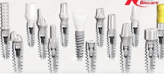 牙齒種植都有哪些優(yōu)點(diǎn)?