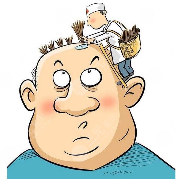 植發(fā)3000個(gè)單位的價(jià)格是多少