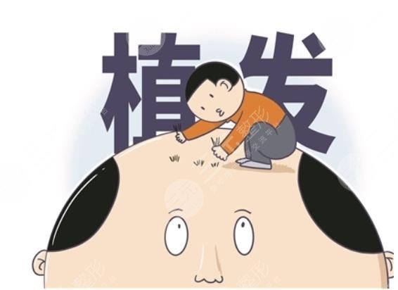 植發(fā)3000個(gè)單位的價(jià)格是多少