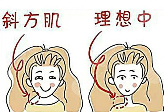 適應(yīng)的人群都有哪些呢?