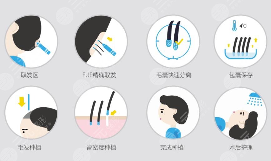 植發(fā)500單位有多大面積?