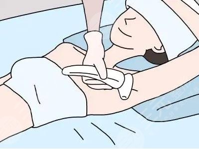 激光脫毛6年后后悔的原因