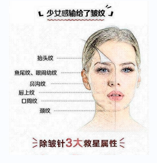 面部除皺成好嗎