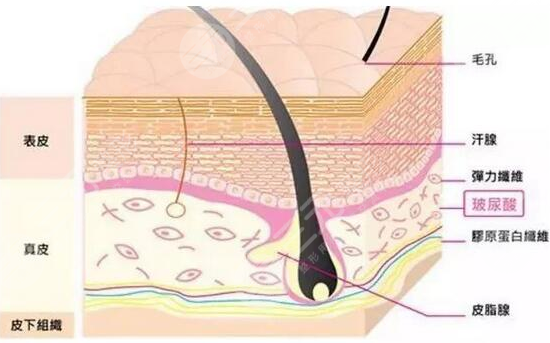美白祛斑和玻尿酸填充哪個好？2者應(yīng)該怎么選？注意事項有哪些呢？